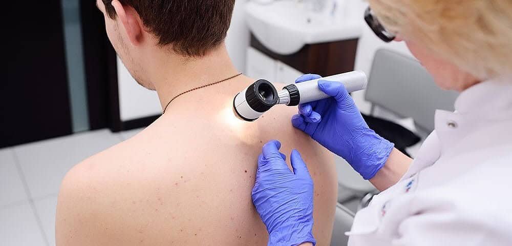 Dermatologo melanoma Milano