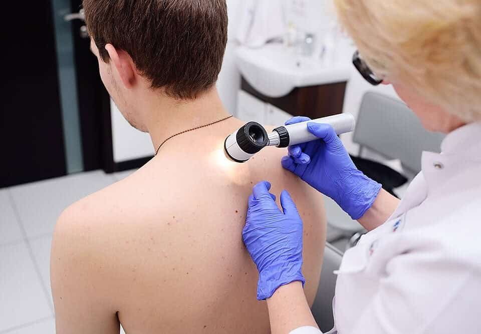 Dermatologo melanoma Milano