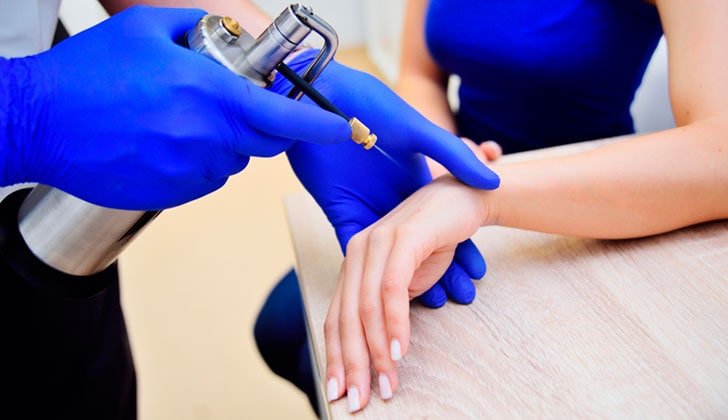 Crioterapia Milano