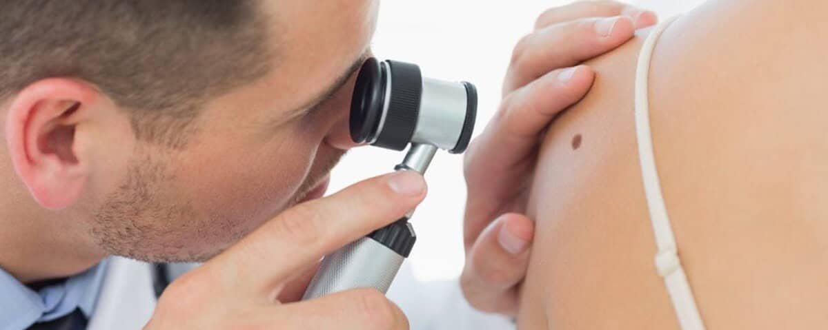 Miglior dermatologo