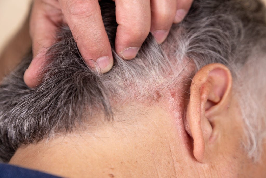 Dermatologo specializzato in psoriasi Milano