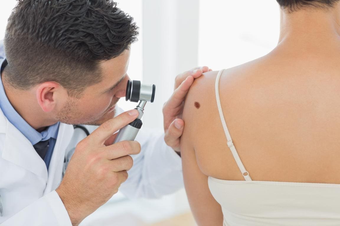 Dermatologo Epiluminescenza Milano