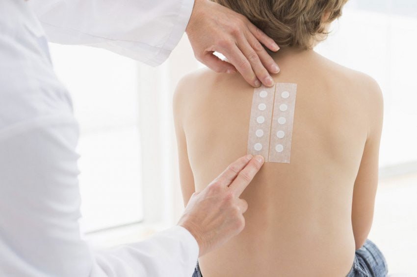 Patch test Milano