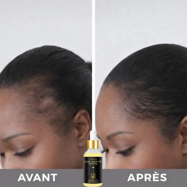 Sérum repousse des cheveux – Biotine, Gingembre et Caféine contre la calvitie