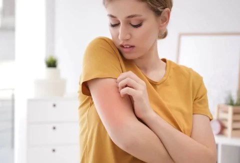 large-main_woman_rash