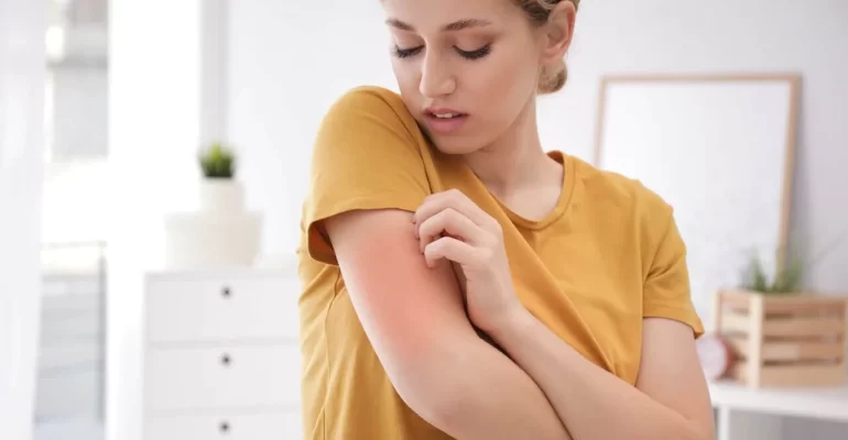 large-main_woman_rash