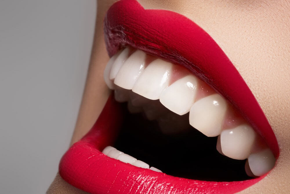 From Professional Self-Consciousness to Absolute Self-Confidence with Porcelain Veneers