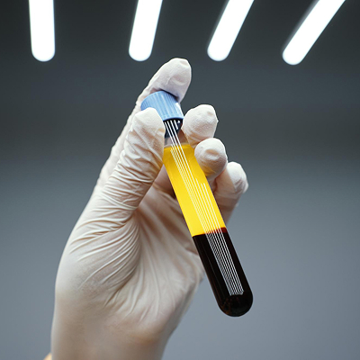 Img-Pz-Medicina-Rigenerativa-PRP