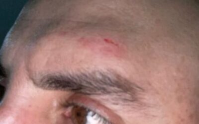 En Campamento, director del hospital La Sagrada Familia fue amenazado y golpeado