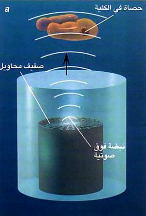 http://oloommagazine.com/images/Articles/16/SCI2000b16N2_H04_0086.jpg