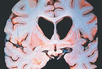 http://oloommagazine.com/images/Articles/19/SCI2003b19N4-5_H05_002944.jpg