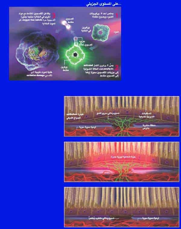 http://oloommagazine.com/images/Articles/20/SCI2004b20N1_H01_003220.jpg