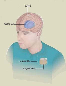 http://oloommagazine.com/images/Articles/21/SCI2005b21N9_H04_004230.jpg
