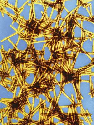 http://oloommagazine.com/images/Articles/21/SCI2005b21N7-8_H01_004124.jpg