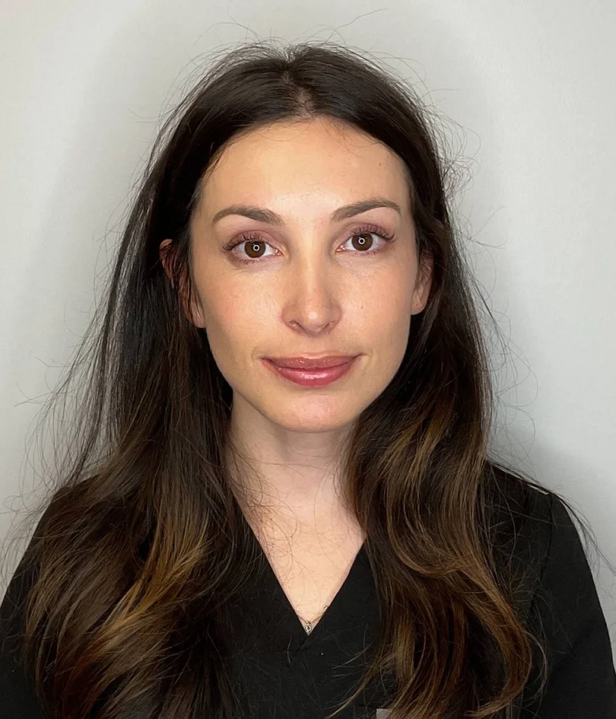 After - Facial Balancing / Fillers Patient 125