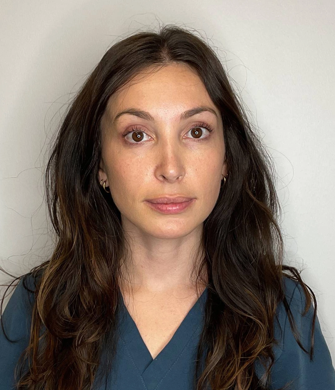 Before - Facial Balancing / Fillers Patient 125