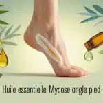 huile essentielle mycose ongle pied avis