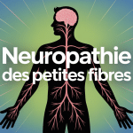 illustration centrale neuropathie des petites fibres espérance de vie