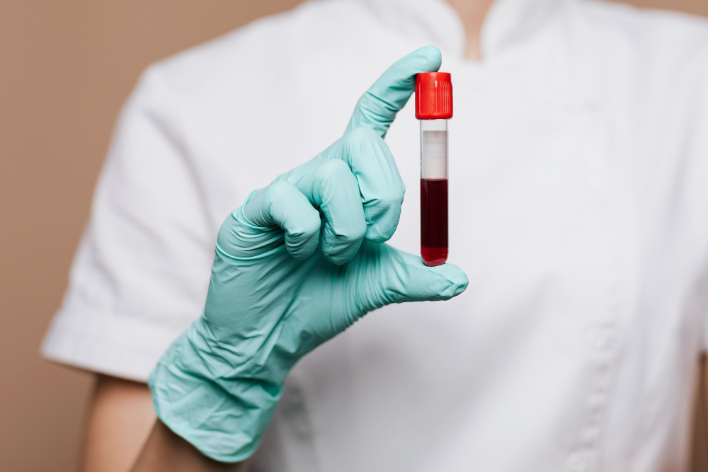 Terapia PRP disfunzione erettile