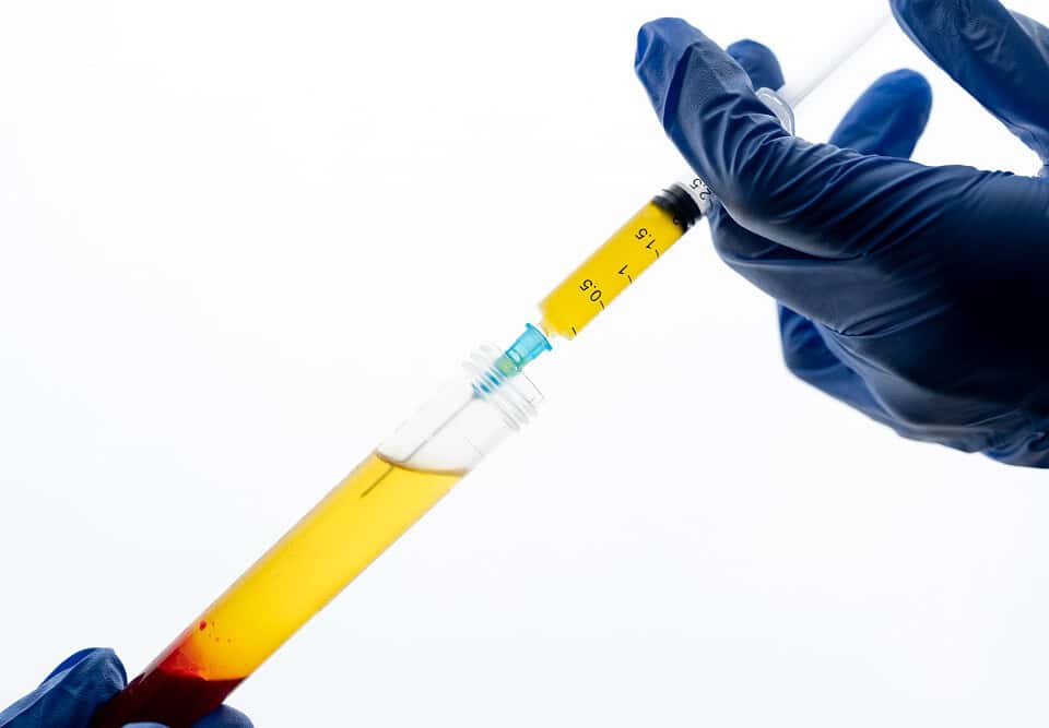 Prp per l'induratio penis plastica