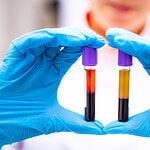 Uso del PRP per l'impotenza maschile