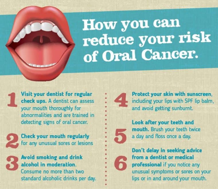 how fast can you get mouth cancer from chewing tobacco HIE Multimedia Oral Cancer: Its Causes, Symptoms,