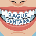 illustration bague dentaire bouche moderne