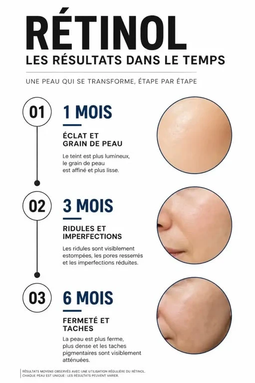 Infographie montrant le délai d'apparition des effets du rétinol sur la peau : 1 mois, 3 mois et 6 mois.