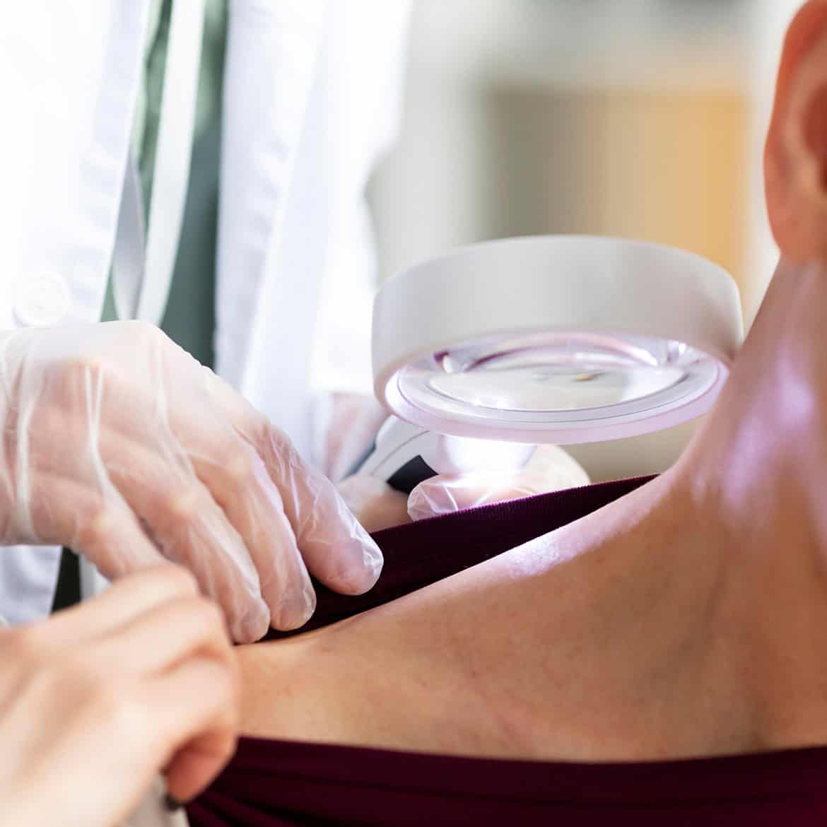 Dermatologist checks the skin on a woman's back