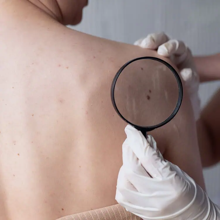 Skin Cancer Surgical Center