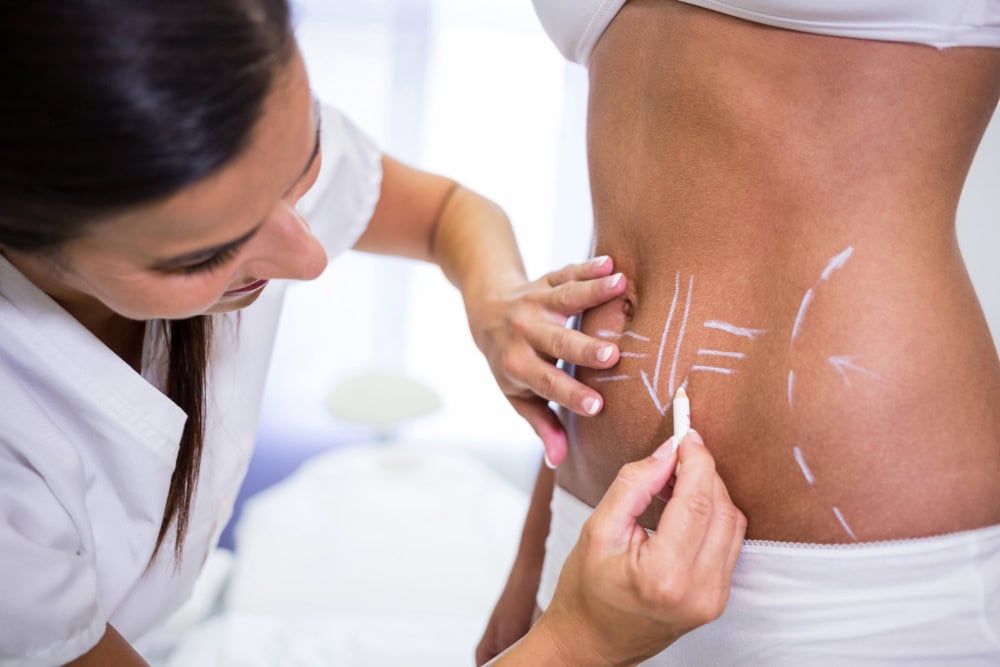 Medical professional marking a patient's lower back with white chalk for surgical planning or procedure markings.