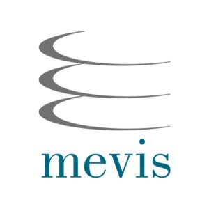 MEVIS