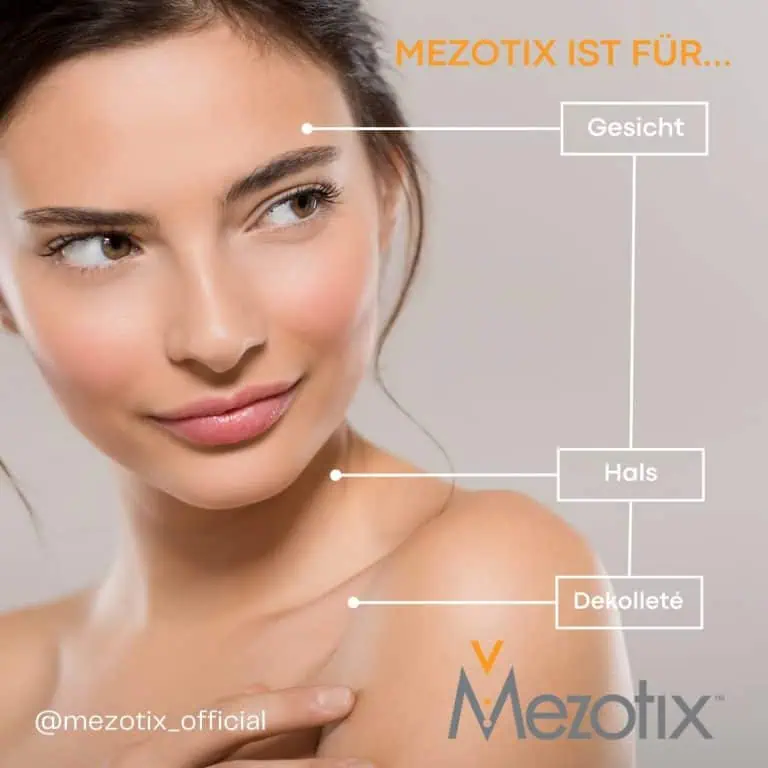 Mezotix heißt das neue Verfahren 5 Mezotix
