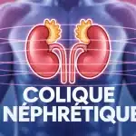 Rein stylisé rouge avec éclairs douleur colique néphrétique