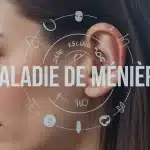 Illustration oreille interne maladie de Ménière équilibre vertiges