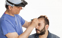 hairtransplant Hair Transplant Packages