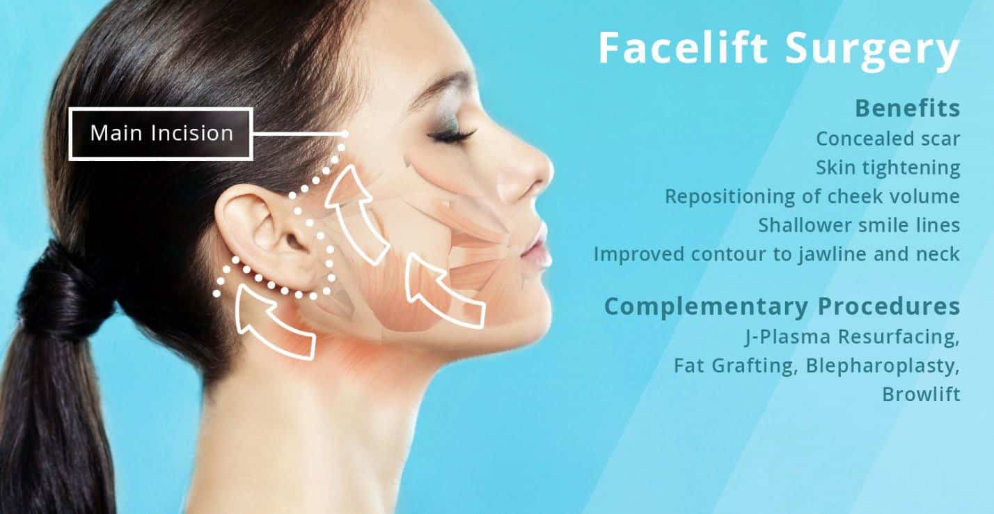 Facelift Surgery in Turkey