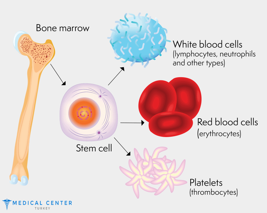 Bone marrow transplantation in Turkey
