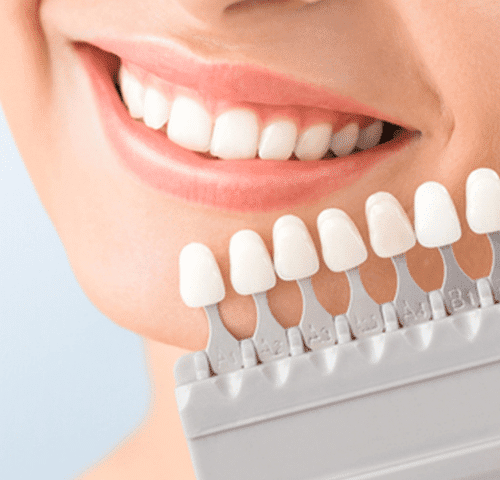 Veneers Cost in turkey