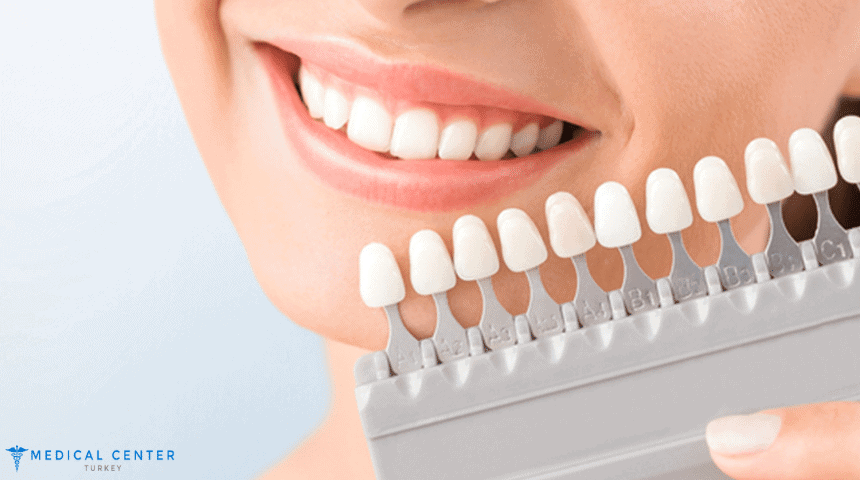Veneers_cost_in_Turkey Veneers Cost in turkey
