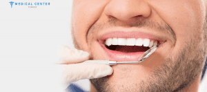 veneers-cost-in-turkey