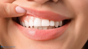 10 countries for Dental implants 4