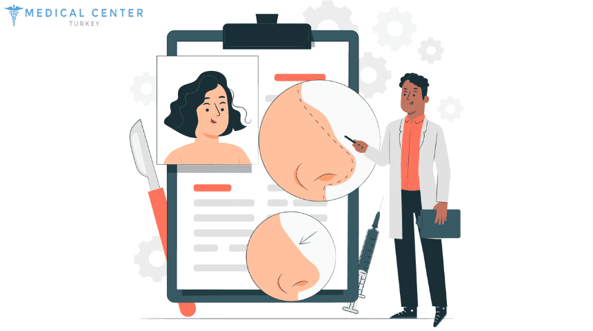 Rhinoplasty, Septoplasy and Deviated Septum Rhinoplasty, Septoplasy and Deviated Septum