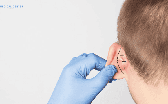 Ear Correction in Turkey