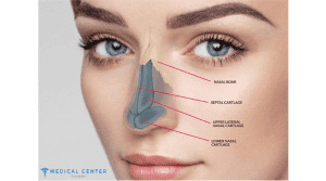 Rhinoplasty Prices in Turkey