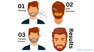 Beard Transplant Cost Turkey 
