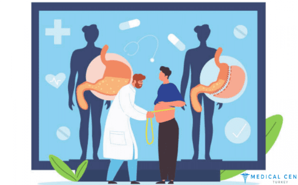 Obesity Surgery in Turkey