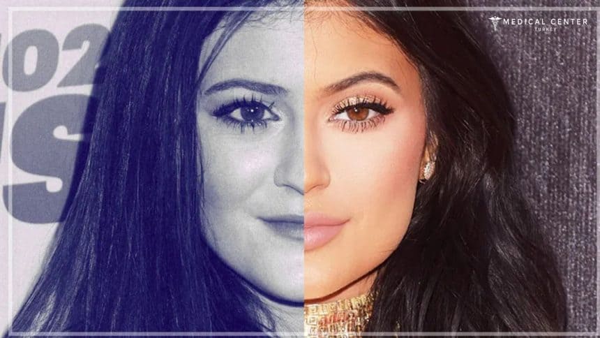 Big Transformation of Kylie Jenner Big Transformation of Kylie Jenner