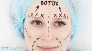 Frequently Asked Questions in Botox