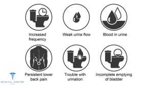 Prostate Cancer Treatment in Turkey